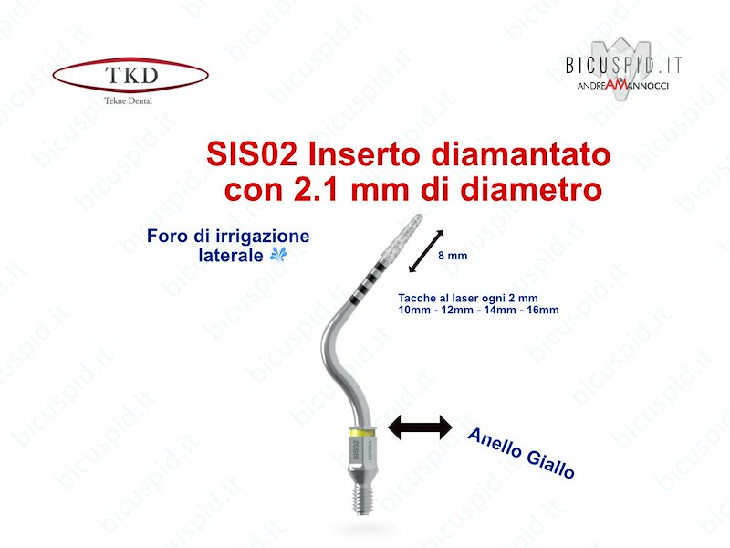 Punte soniche per la preparazione della sede implantare - Sonosurgery TKD Tecne Dental
