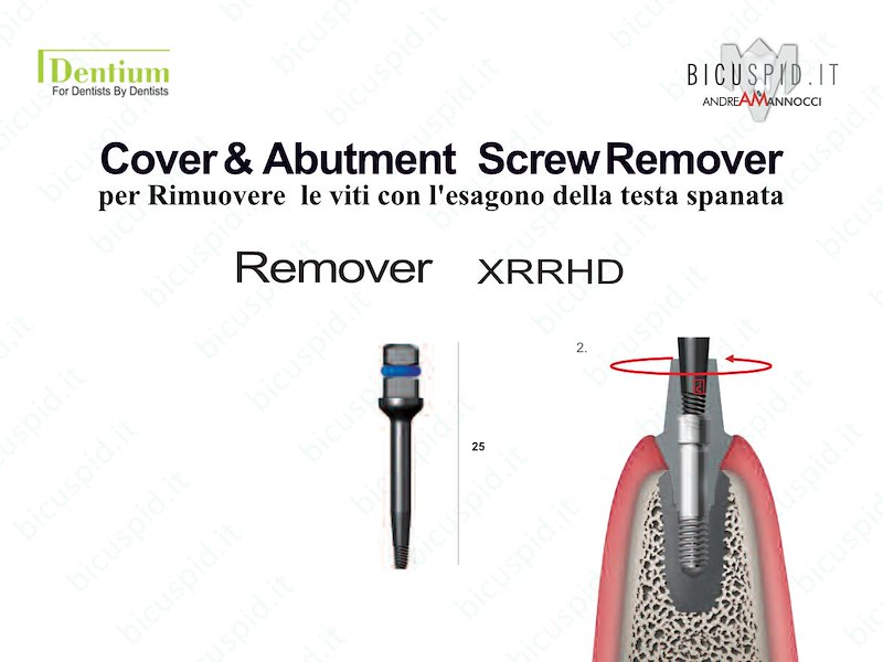 Come rimuovere le viti con esagono spanato Cover e Screw Remover