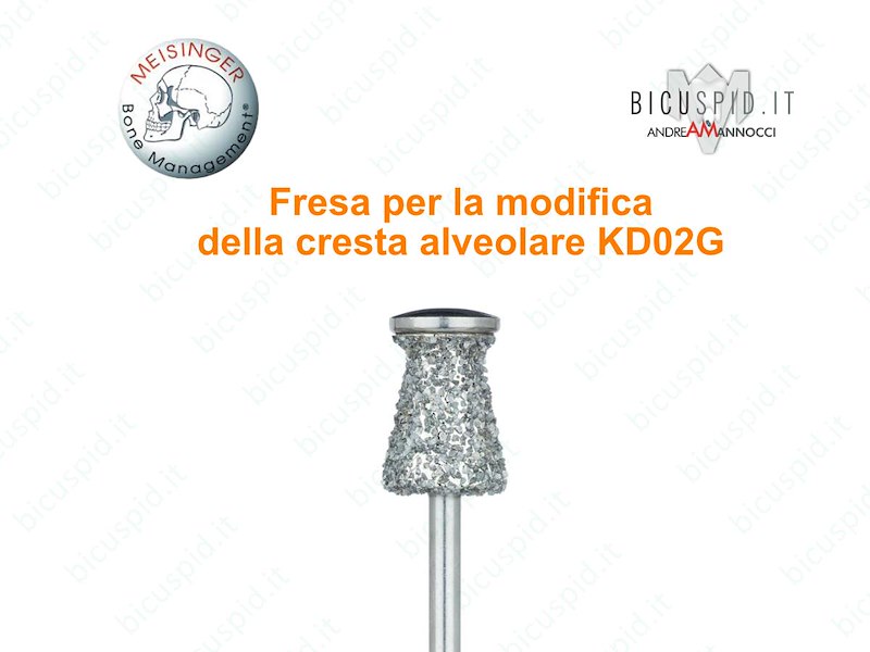 Fresa per la modifica della cresta alveolare KD02G Meisinger