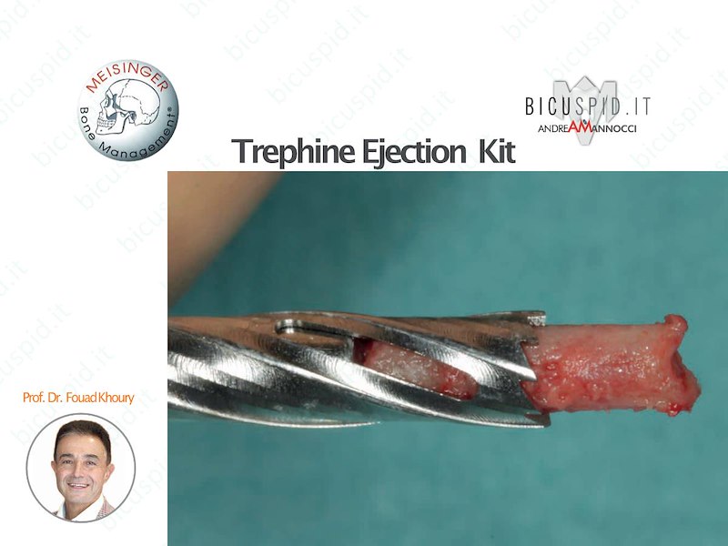 Trephine Ejection Kit Meisinger Khoury Line