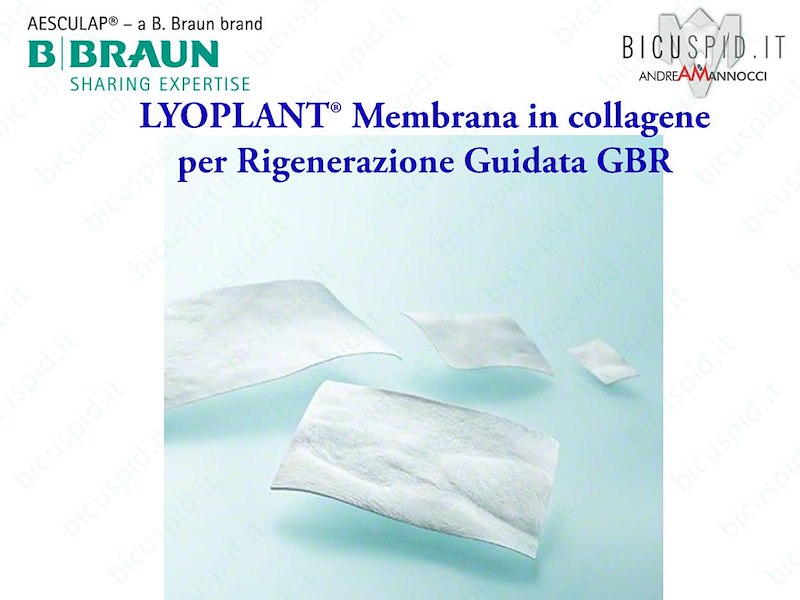 LYOPLANT® Membrana in collagene - Misura 1,5 X 3 cm - codice 1066102 - Box da 2 membrane 