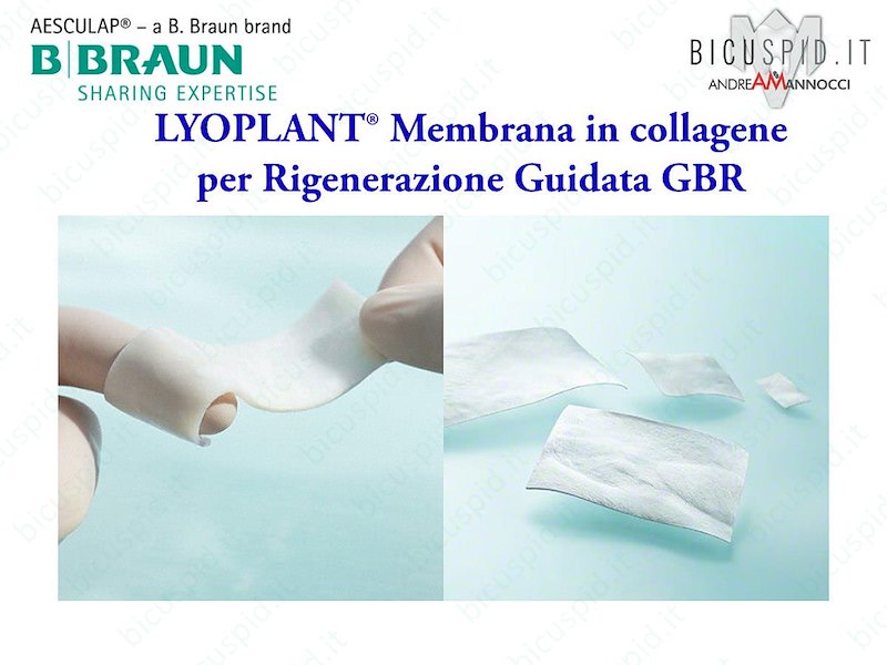 LYOPLANT® Membrana in collagene - Misura 1,5 X 3 cm - codice 1066102 - Box da 2 membrane 