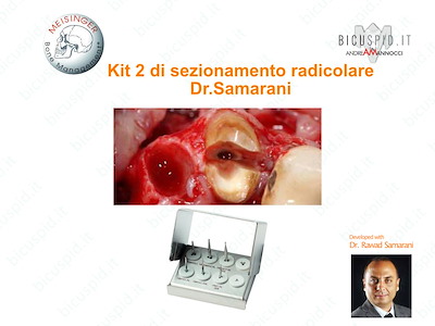 Kit sezionamento radicolare Dr. Samarani BRSS2