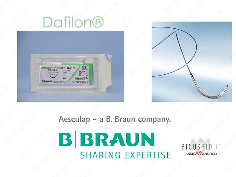 DAFILON 4/0 - 1/2 CERCHIO - Suture chirurgiche Monofilamento non assorbibile in poliammide