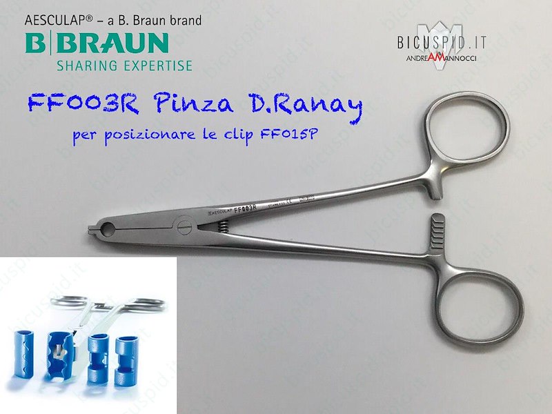 FF003R PINZA D.RANAY P.POSA.L.CLIPS- Conf. della sola pinza 