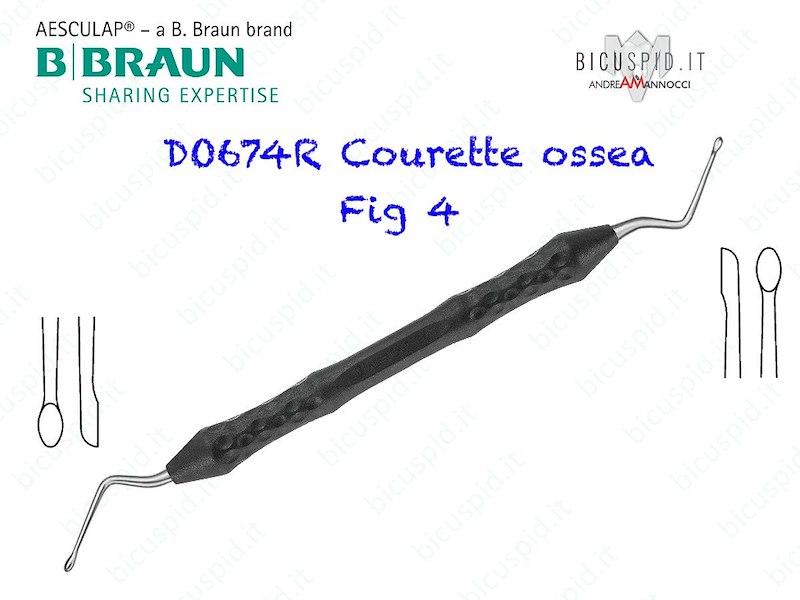 DO674R CURETTE TAGLIENTE DOPPIA HEMINGWAY ERGONOMICA #4 170MM  - CONF. DA  1 PZ.