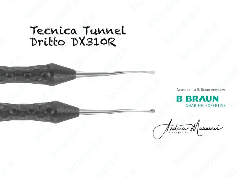 DX310R  Strumento Dritto Tecnica del Tunnel o Tunnel technique - Ergoperio
