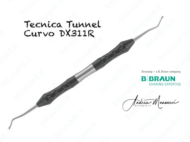 DX311R  Strumento angolato per la Tecnica del Tunnel o Tunnel technique - Ergoperio