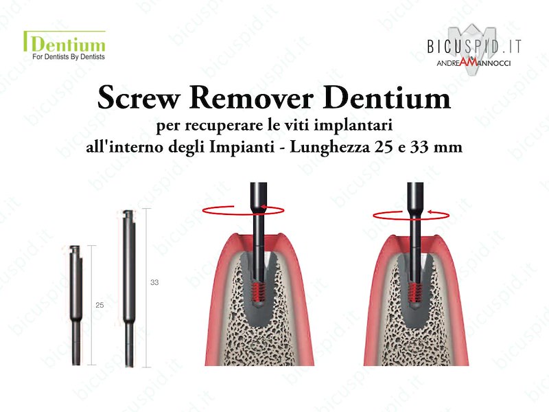 Screw Remover Dentium - Per recuperare le viti fratturate all'interno degli impianti