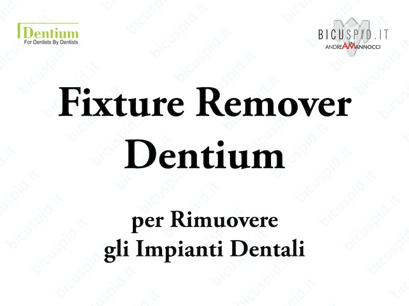 Fixture Remover - Per la Rimozione di un Impianto Dentale - I Componenti