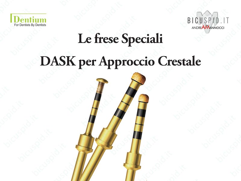 Le frese Speciali del DASK della Dentium - Approccio Crestale 