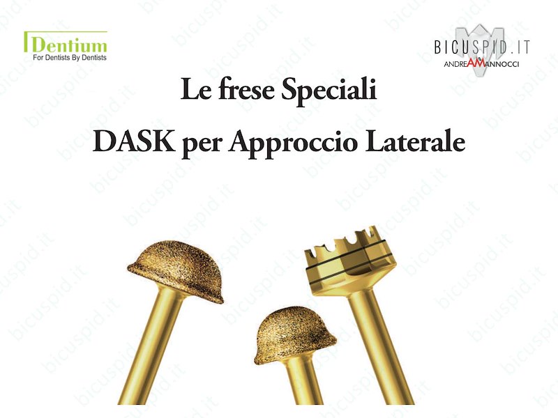 Le frese Speciali del DASK della Dentium - Approccio Laterale