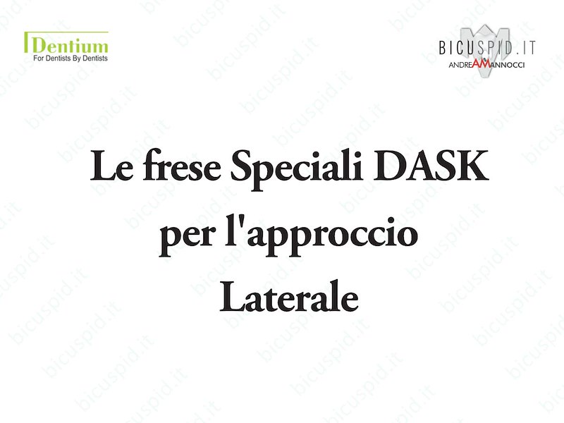 Le frese Speciali del DASK della Dentium - Approccio Laterale