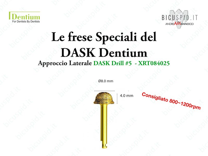 Le frese Speciali del DASK della Dentium - Approccio Laterale