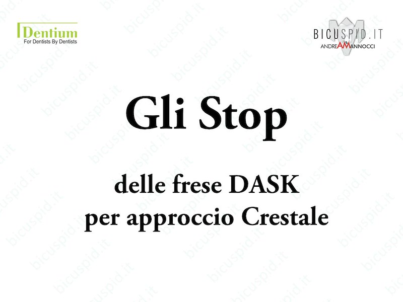 Gli Stop delle frese DASK per Approccio Crestale 